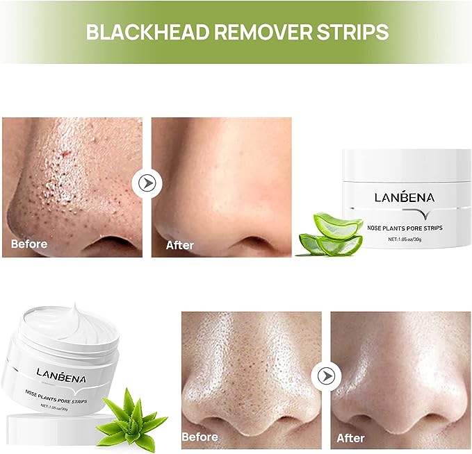 LANBENA Blackhead Whiteheads Remover Mask Facial Peeling Nose Strip Acne Deep Cleansing 30g